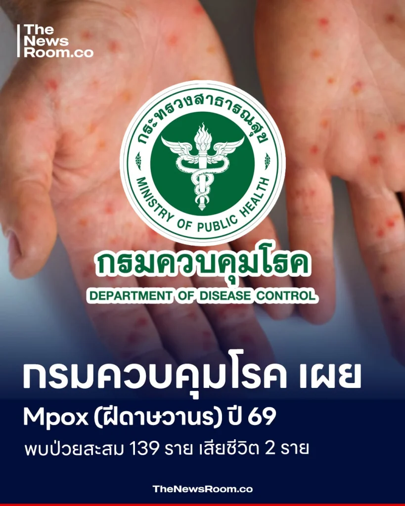 กรมควบคุมโรค เผย Mpox (ฝีดาษวานร) ปี 69 พบป่วยสะสม 139 ราย เสียชีวิต 2 ราย